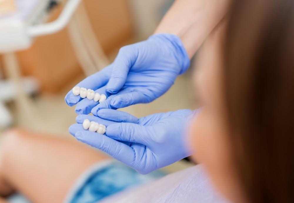 Crowns and Veneers: Understanding the Differences